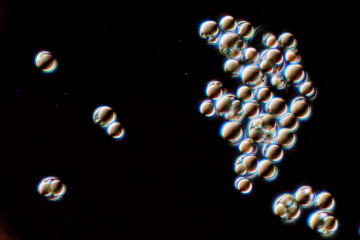 bubbles on a black background
